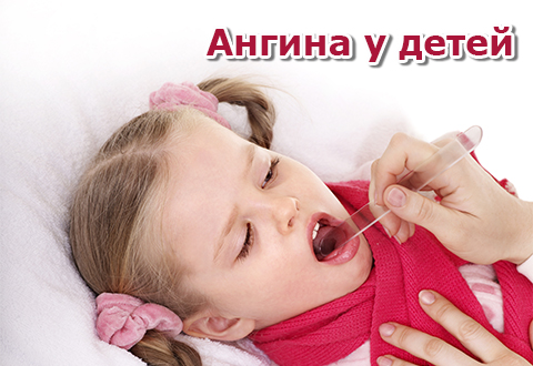 Ангина у детей